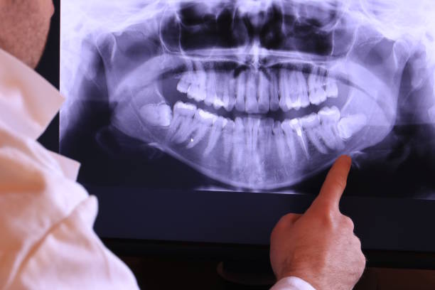 Best Emergency Dental Care for Broken or Chipped Teeth in Dekal, IL